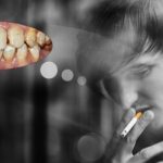 Hút thuốc sau khi nhổ răng có sao không?