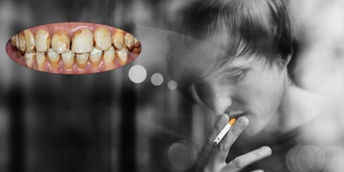 thuốc lá làm răng bị ố vàng