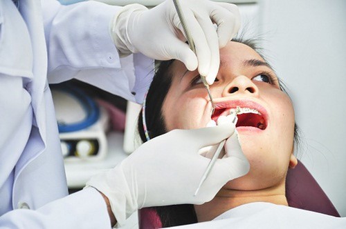 Nhổ răng là thủ thuật nha khoa đơn giản, tuy nhiên cần lưu ý chăm sóc răng sau khi nhổ để tránh làm nhiễm trùng vết thương