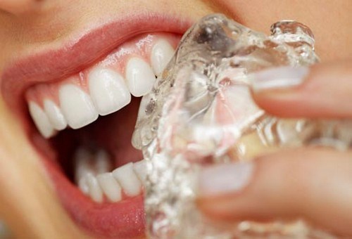 Tại sao răng bị đau nhức khủng khiếp khi uống nước đá lạnh-2