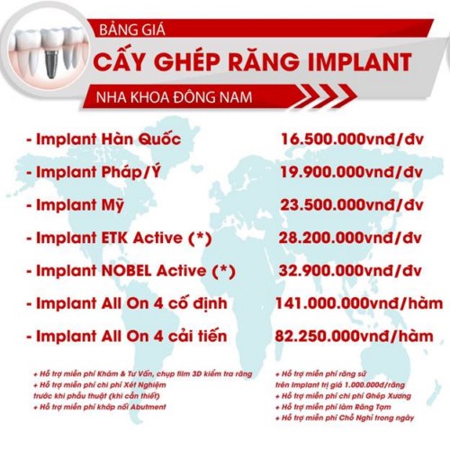 bảng giá cấy ghép implant