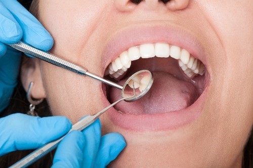 điều trị răng miệng tại nha khoa