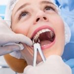 [TPHCM] Top 10 nha khoa nhổ răng khôn an toàn không đau
