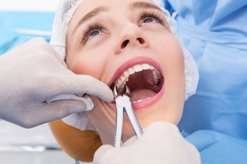 "Đề Cử" 10 nha khoa nhổ răng không đau và an toàn nhất TPHCM