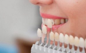 Read more about the article Nên chọn 6 nha khoa bọc răng sứ nào sau đây ở TPHCM