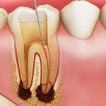 Top 6 nha khoa Chữa Tủy Răng giỏi chất lượng TPHCM
