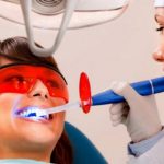[TPHCM] Top 7 nha khoa Tẩy Trắng Răng đẹp và an toàn nhất