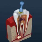 Top 10 nha khoa điều trị tủy răng uy tín nhất huyện Nhà Bè