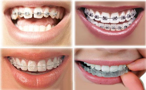 hình ảnh  răng bác sĩ nha khoa Nha khoa nụ cười Miệng Y khoa Làm  trắng phòng khám bệnh kinh doanh dọn dẹp sáng tạo khỏe mạnh điều trị  Huy hiệu