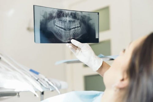 Chụp x-quang răng là một bước rất quan trọng