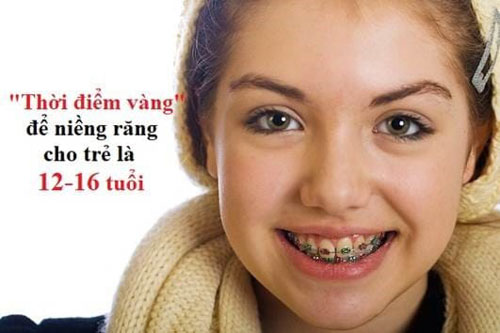 Độ tuổi niềng răng tốt nhất là từ 12 – 16 tuổi