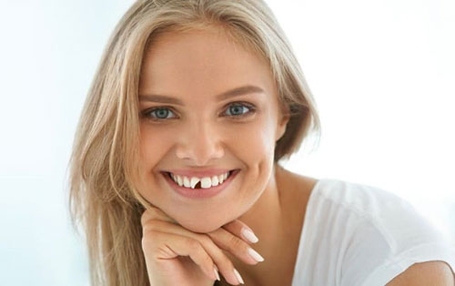 Mẻ răng cửa ảnh hưởng nghiêm trọng đến thẩm mỹ và chức năng răng