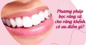 Read more about the article Bọc răng sứ cho răng khểnh có hiệu quả không?