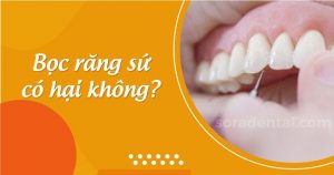 Read more about the article Bọc răng sứ có hại không? Cần lưu ý những gì?