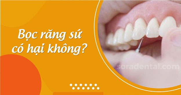 Read more about the article Bọc răng sứ có hại không? Cần lưu ý những gì?