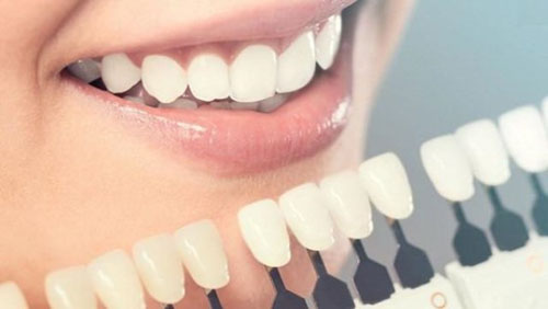 Bọc răng sứ mang lại nhiều ưu điểm