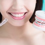 Cách niềng răng hô hiệu quả lâu dài an toàn