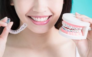 Read more about the article Cách niềng răng hô hiệu quả lâu dài an toàn