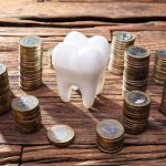 Chi phí hàn răng sâu giá bao nhiêu?