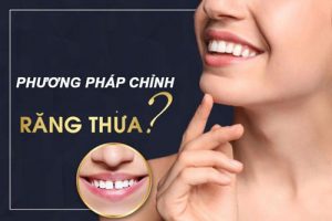 Read more about the article Chỉnh răng thưa hết bao nhiêu tiền?