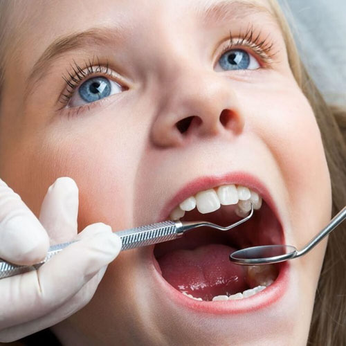 Niềng răng 1 cái có hiệu quả tùy thuộc vào từng tình trạng ở mỗi người