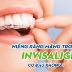 Niềng răng Invisalign có đau không? Ưu nhược điểm là gì?
