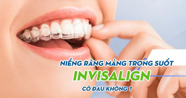 Read more about the article Niềng răng Invisalign có đau không? Ưu nhược điểm là gì?