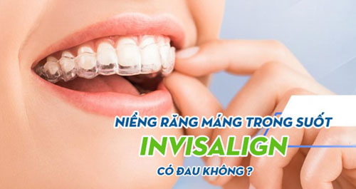 Niềng răng Invisalign có đau không?