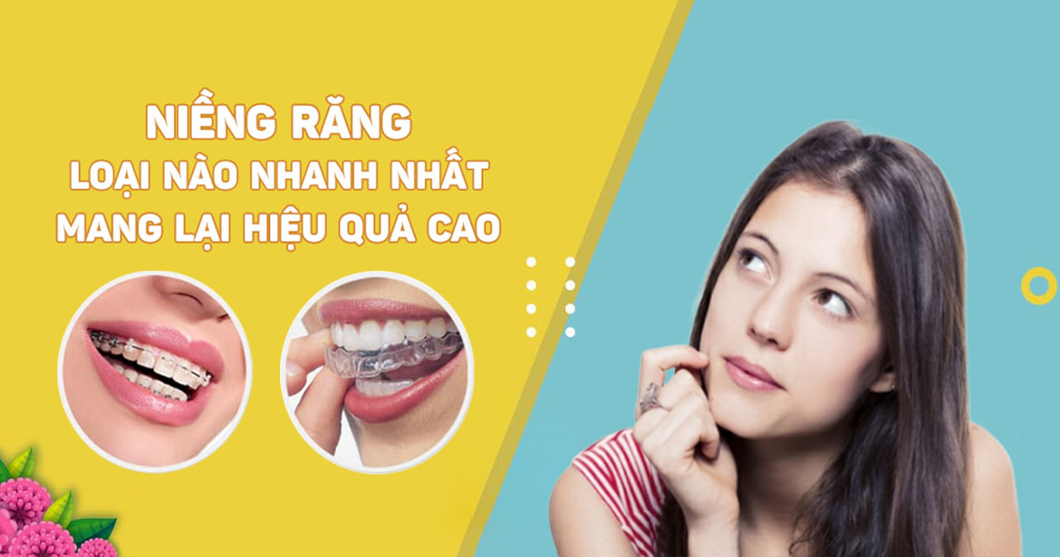 Read more about the article Niềng răng nhanh nhất mất bao lâu? Loại nào hiệu quả nhất?