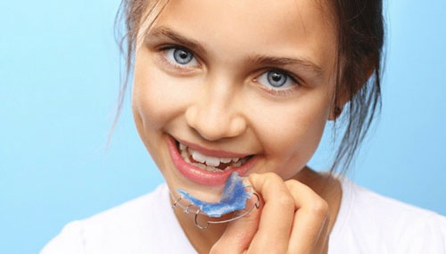 Niểng răng tháo lắp với khung hàm tháo lắp dành cho trẻ em
