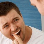 Răng cửa bị lung lay nhẹ phải làm sao để khắc phục?