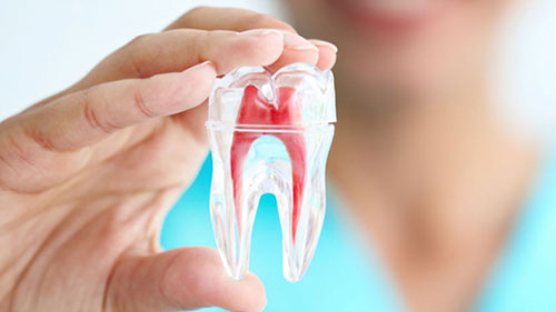 Thăm khám điều trị phòng ngừa biến chứng viêm tủy răng