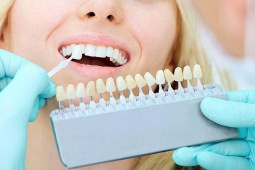 Thăm khám và điều trị lại khi răng sứ bị rớt