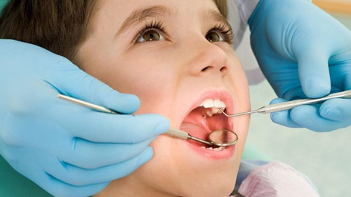 Thời gian niềng răng ở trẻ em sẽ nhanh hơn người trưởng thành