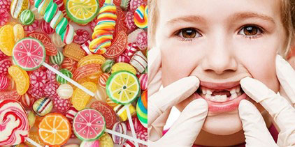 Thực phẩm ngọt nguyên nhân gây sâu răng
