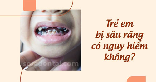 Trẻ em bị sâu răng có nguy hiểm không?