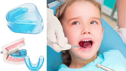 Trẻ từ 6 – 11 tuổi có thể đeo hàm trainer để hướng dẫn răng mọc đúng vi trí