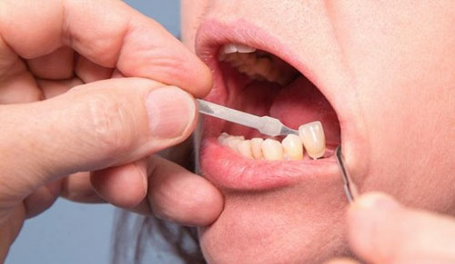 Thăm khám tình trạng răng miệng thực tế