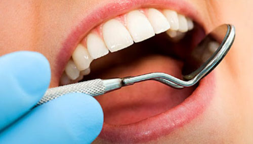Bọc răng sứ cho răng cửa có ảnh hưởng gì không?