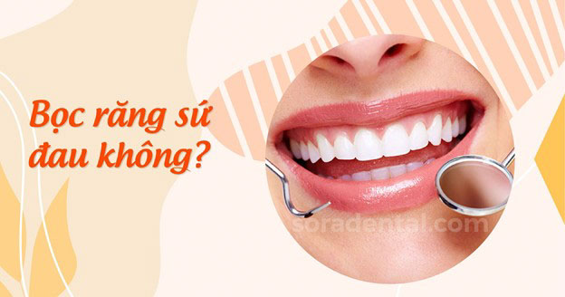 Read more about the article Bọc răng sứ đau không?