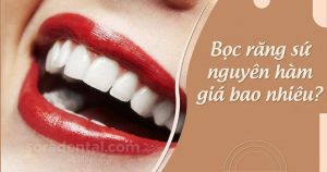 Read more about the article Bọc răng sứ nguyên hàm giá bao nhiêu?