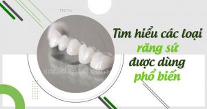 Read more about the article Các loại răng sứ phổ biến và ưu nhược điểm từng loại