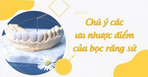 Read more about the article Các ưu nhược điểm của bọc răng sứ thẩm mỹ
