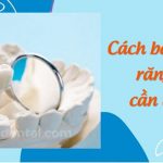 Cách bảo quản răng sứ chuẩn nhất đảm bảo tuổi thọ răng