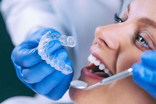 Chi phí niềng răng trong suốt Invisalign phụ thuộc nhiều yếu tố