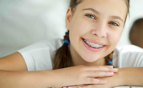 Gia đoạn 12 – 16 tuổi là thời điểm tốt nhất để chỉnh hình răng