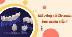 Read more about the article Giá răng sứ Zirconia bao nhiêu tiền? Bảng giá mới nhất