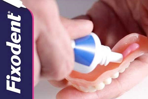 Keo dán răng sứ được áp dụng cho nhiều phương pháp phục hình