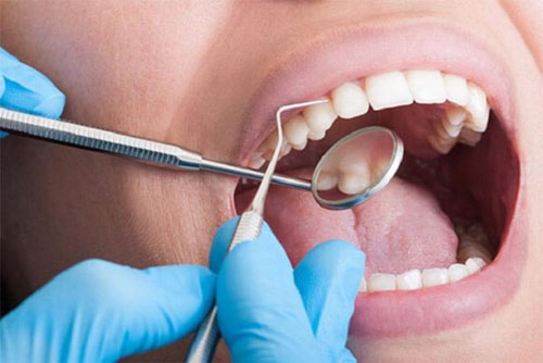 Lựa chọn cơ sở điều trị chuyên sâu bọc răng sứ