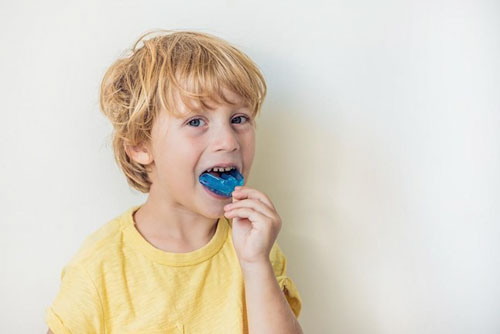 Niềng răng silicon dùng cho trẻ từ 6 – 11 tuổi